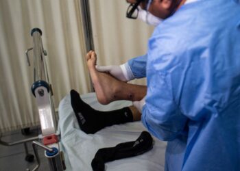 Comité Nacional para la Vigilancia Epidemiológica emite aviso por viruela de mono