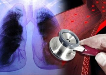 Se exhorta a la secretaria de salud a intensificar la atención a pacientes con hipertensión pulmonar