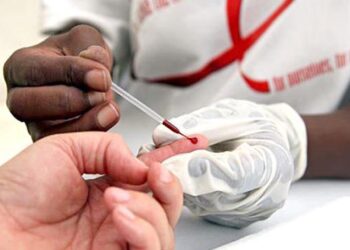 Al alza, casos de VIH en México