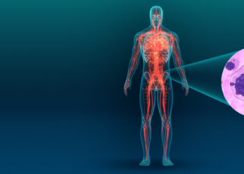 Un nuevo blanco terapéutico contra el mieloma múltiple: el rol del colesterol y el hierro