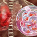 Tuberculosis: detectar a tiempo para frenar una epidemia silenciosa El arte de disfrutar con estilo y sentido.