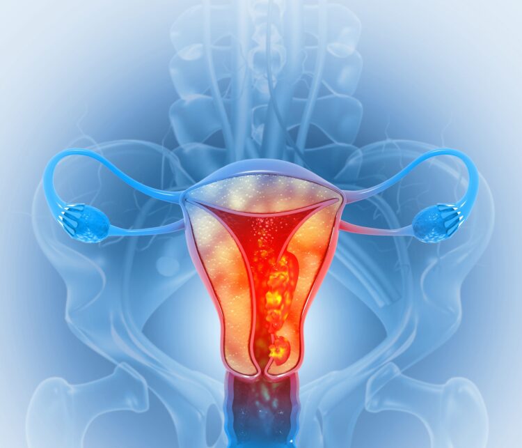 Cáncer ginecológico: tratamientos menos agresivos con la misma eficacia